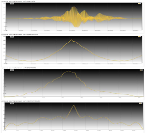 Acoustic Throat Infection Analyser