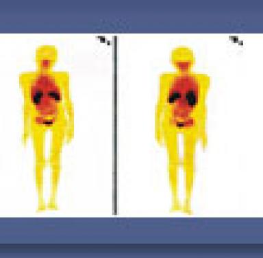 Pharmacoscintigraphy Modules for Infection/Inflammation